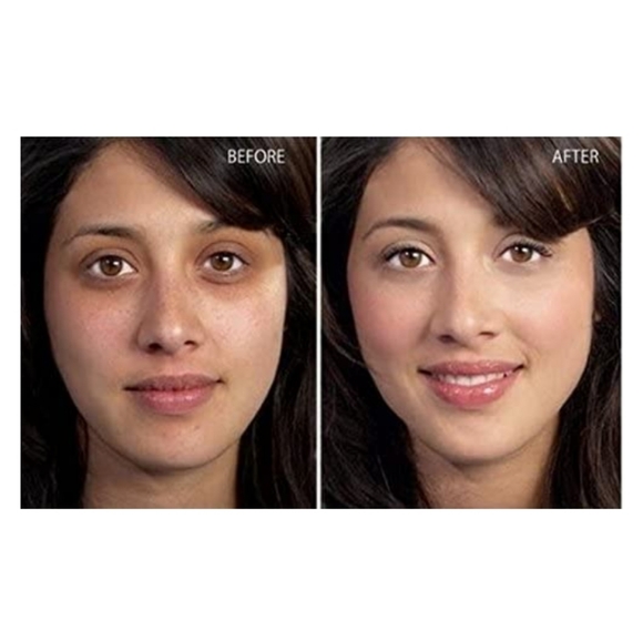 🆕Under Eye dark circles & Puffiness treatment - Picture 2 of 12